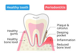 tooth